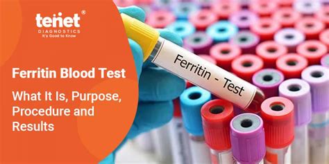 s-ferrit|Ferritin Test: What It Is, Purpose, Procedure & Results